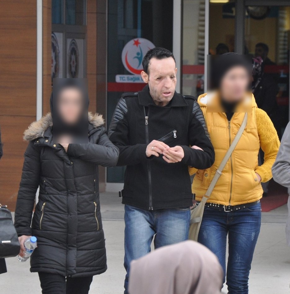 Balıkesir’in Edremit ilçesinde narkotik polisinin yaptığı operasyonda gözaltına alınan 10 kişi arasında yüz ve çene nakli yapılan Recep Sert’in ...